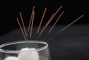 What is Acupuncture, the needles tat are used